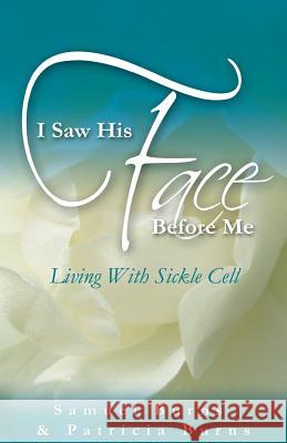 I Saw His Face Before Me - Living with Sickle Cell Anemia SAMUEL A. BURNS PATRICIA A. BURNS  9781937829735 Total Publishing & Media
