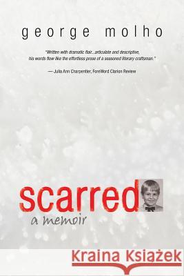 Scarred: A Memoir Molho, George 9781938908347