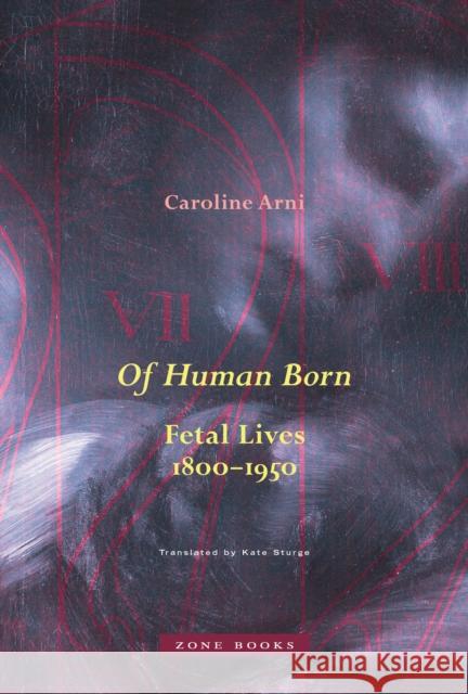 Of Human Born: Fetal Lives, 1800–1950  9781942130895 Zone Books