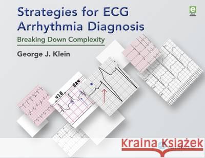 Strategies for ECG Arrhythmia Diagnosis: Breaking Down Complexity George J Klein 9781942909118