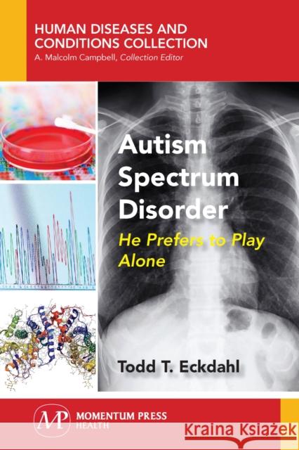 Autism Spectrum Disorder: He Prefers to Play Alone Todd T. Eckdahl 9781944749590 Momentum Press