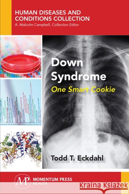 Down Syndrome: One Smart Cookie Todd T. Eckdahl 9781944749613 Momentum Press