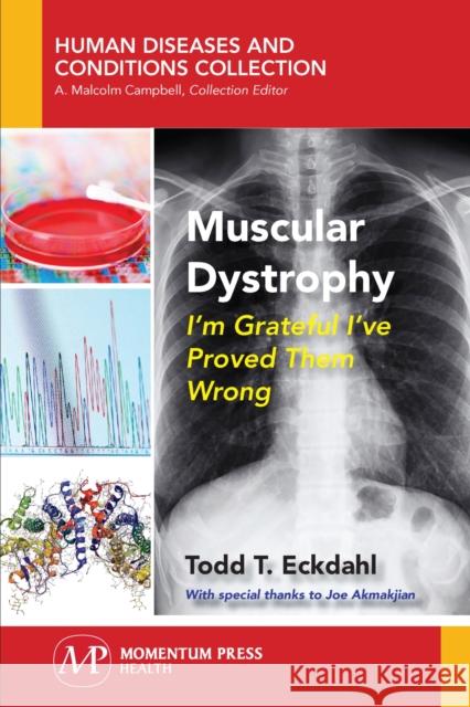 Muscular Dystrophy: I'm Grateful I've Proved Them Wrong Todd T. Eckdahl 9781944749675 Momentum Press