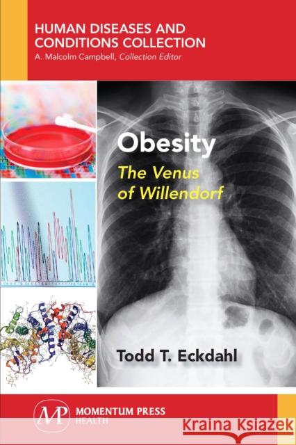 Obesity: The Venus of Willendorf Todd T. Eckdahl 9781944749712 Momentum Press