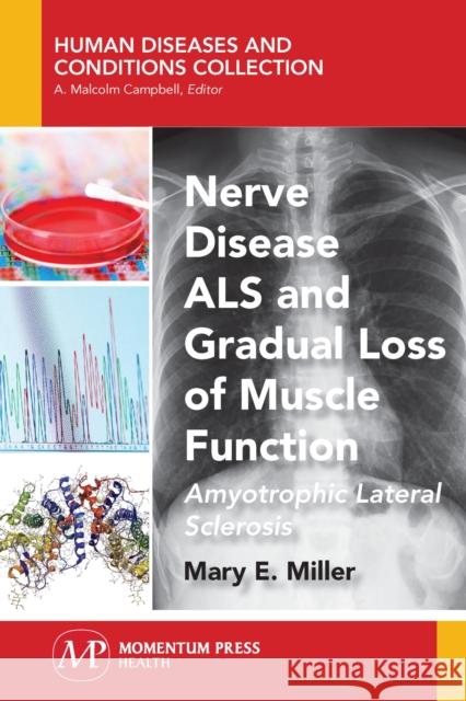 Nerve Disease ALS and Gradual Loss of Muscle Function: Amyotrophic Lateral Sclerosis Mary E. Miller 9781944749798 Momentum Press