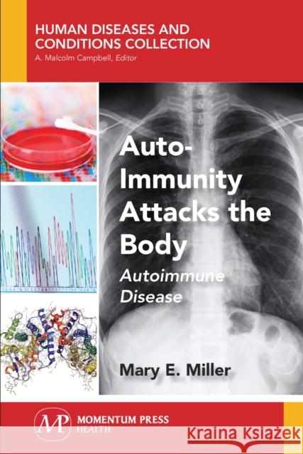 Auto-Immunity Attacks the Body: Autoimmune Disease Mary E. Miller 9781944749811 Momentum Press