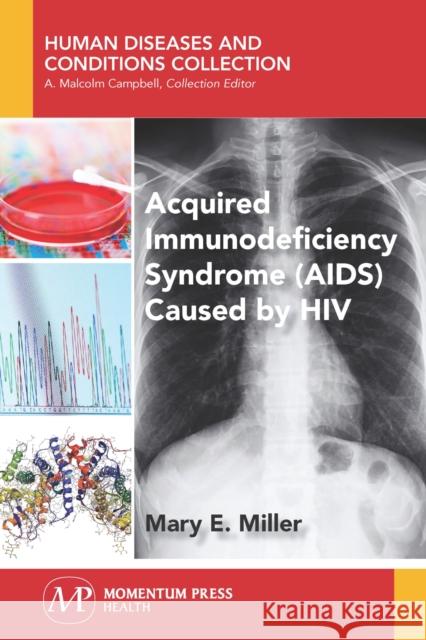 Acquired Immunodeficiency Syndrome (AIDS) Caused by HIV Mary E. Miller 9781944749934 Momentum Press