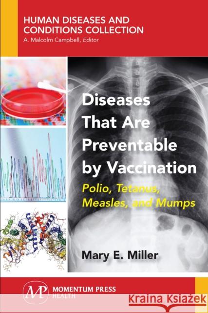 Diseases That Are Preventable by Vaccination: Polio, Tetanus, Measles, and Mumps Mary E. Miller 9781944749958 Momentum Press