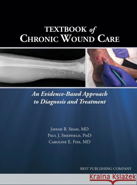 Textbook of Chronic Wound Care: An Evidence-Based Approach to Diagnosis Treatment Jayesh B Shah, Paul J Sheffield, Caroline E Fife 9781947239074 Best Publishing Company