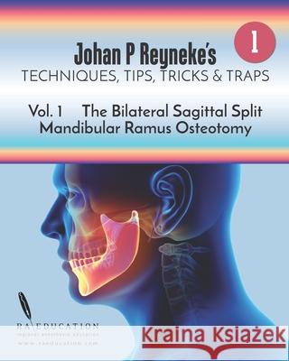 Johan P Reyneke's Techniques, Tips, Tricks and Traps: Volume 1: The Bilateral Sagittal Split Mandibular Ramus Osteotomy Johan P. Reyneke 9781948083157 Raeducation.com LLC Publications