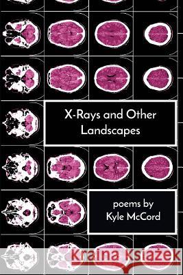 X-Rays and Other Landscapes Kyle McCord 9781949487022 Trio House Press