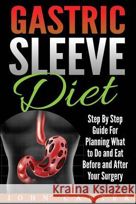 Gastric Sleeve Diet: Step By Step Guide For Planning What to Do and Eat Before and After Your Surgery John Carter 9781951103583