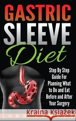 Gastric Sleeve Diet: Step By Step Guide For Planning What to Do and Eat Before and After Your Surgery John Carter 9781951103941 Guy Saloniki