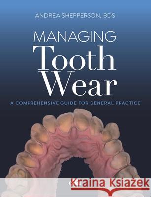 Managing Tooth Wear Andrea Shepperson 9781957260334 Edra Publishing US LLC