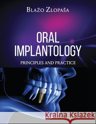 Oral Implantology: Principles and Practice Blazo Zlopasa 9781967421480 Blazo Zlopasa Publications