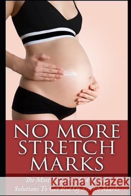 No More Stretch Marks: The Most Effective and Simple Solutions to Get Rid of Stretch Marks Elizabeth Grace 9781973128236 Independently Published
