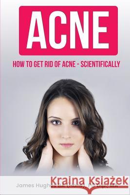 Acne: How to get rid of acne - scientifically Hughes, James 9781974054671 Createspace Independent Publishing Platform