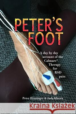 Peter's Foot: Calmare Treatment for RSD Pain Relief Peter M. Hinninger Judy M. Alberta 9781974217205 Createspace Independent Publishing Platform