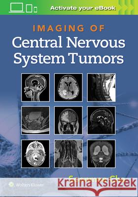Imaging of Central Nervous System Tumors Cha, Soonme 9781975103743 LWW