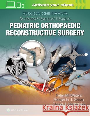 Boston Children's Illustrated Tips and Tricks in Pediatric Orthopaedic Reconstructive Surgery Waters, Peter M. 9781975103880 Wolters Kluwer Health