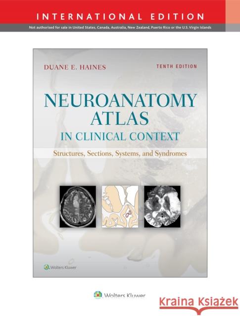 Neuroanatomy Atlas in Clinical Context: Structures, Sections, Systems, and Syndromes Haines Duane E. 9781975106683