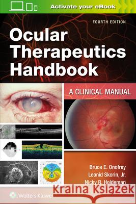 Ocular Therapeutics Handbook: A Clinical Manual Bruce E. Onofrey Leonid Skorin Nicky R. Holdeman 9781975109042 LWW