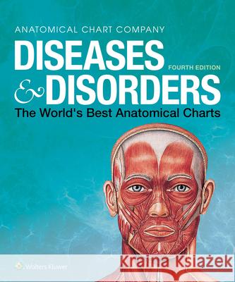 Diseases & Disorders: The World's Best Anatomical Charts Anatomical Chart Company 9781975110239 LWW