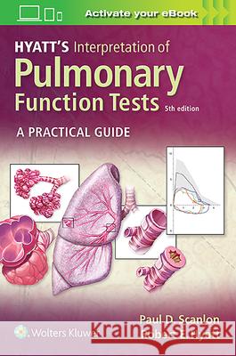 Hyatt's Interpretation of Pulmonary Function Tests Paul D. Scanlon 9781975114343