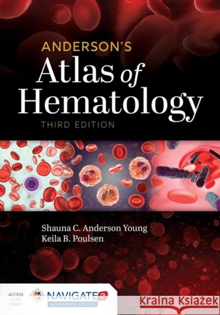 Anderson's Atlas Of Hematology Keila B. Poulsen 9781975118259 Jones and Bartlett Publishers, Inc