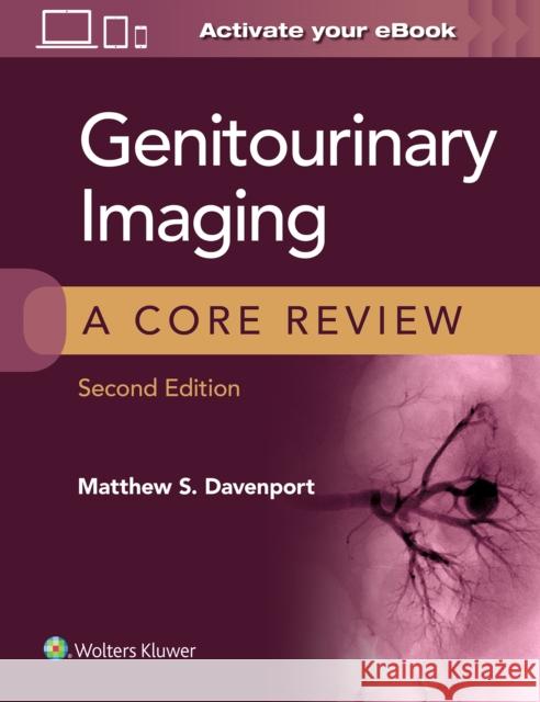 Genitourinary Imaging: A Core Review Matthew Davenport 9781975119874