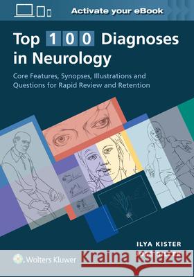 Top 100 Diagnoses in Neurology Biller Jose 9781975121112