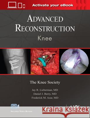 Advanced Reconstruction: Knee: Print + eBook with Multimedia Lieberman, Jay R. 9781975121747 AAOS