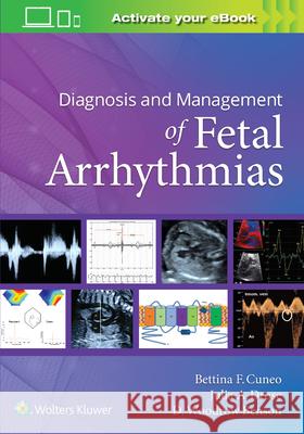 Diagnosis and Management of Fetal Arrhythmias Bettina Cuneo 9781975122867 Lippincott Raven