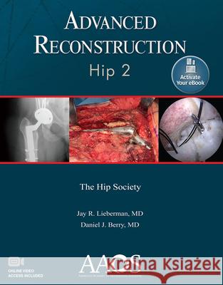 Advanced Reconstruction: Hip 2: Print + eBook with Multimedia Lieberman, Jay R. 9781975123833 AAOS