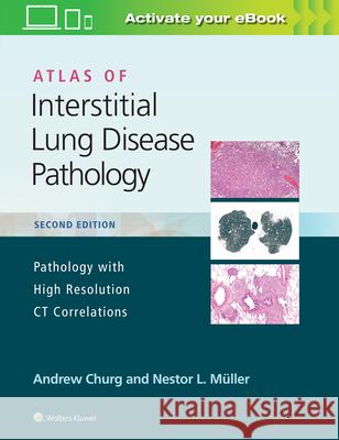 Atlas of Interstitial Lung Disease Pathology Andrew Churg 9781975124670 Wolters Kluwer Health