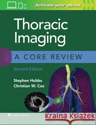 Thoracic Imaging: A Core Review Christian Cox 9781975126223 Wolters Kluwer Health