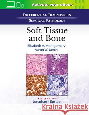 Differential Diagnoses in Surgical Pathology: Soft Tissue and Bone Elizabeth A. Montgomery Aaron James 9781975136024 LWW