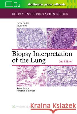 Biopsy Interpretation of the Lung Saul Suster David Suster 9781975136581 LWW