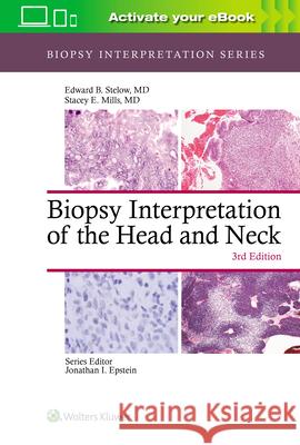 Biopsy Interpretation of the Head and Neck Edward Stelow 9781975139360