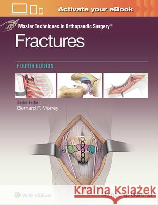 Master Techniques in Orthopaedic Surgery: Fractures Michael J. Gardner 9781975139407