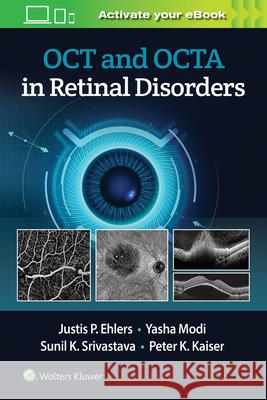 Oct and Octa in Retinal Disorders Ehlers, Justis P. 9781975144227 Wolters Kluwer Health