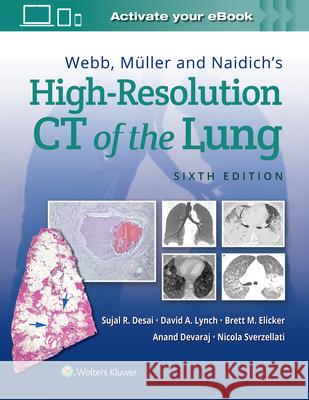 Webb, Müller and Naidich's High-Resolution CT of the Lung Desai, Sujal 9781975144432