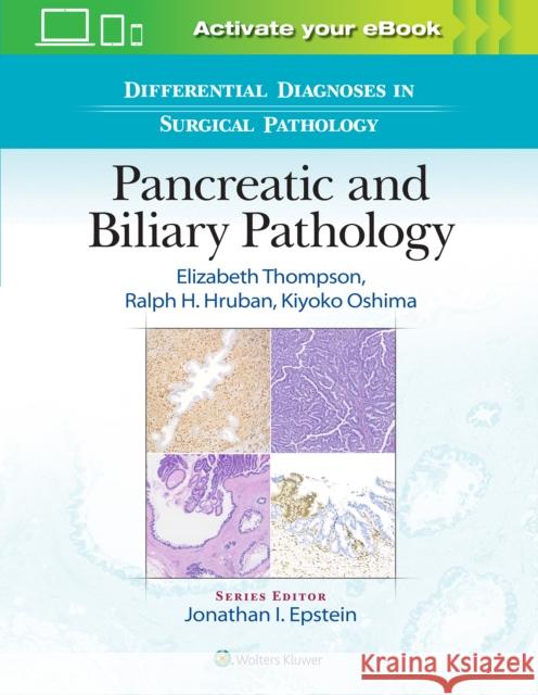Differential Diagnoses in Surgical Pathology: Pancreatic and Biliary Pathology Elizabeth Thompson Ralph H. Hruban Kiyoko Oshima 9781975144739 