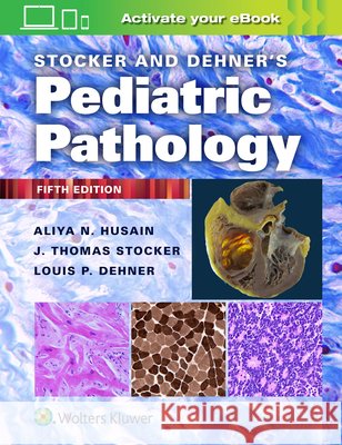 Stocker and Dehner's Pediatric Pathology Louis P. Dehner 9781975144814