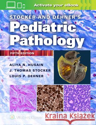 Stocker and Dehner's Pediatric Pathology Louis P. Dehner 9781975144814