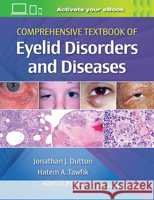 Comprehensive Textbook of Eyelid Disorders and Diseases Dutton, Jonathan 9781975146146 LWW
