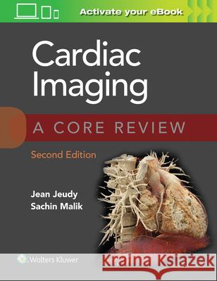 Cardiac Imaging: A Core Review Jean Jeudy Maliik Sachin 9781975147990 Wolters Kluwer Health