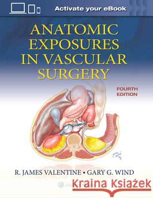 Anatomic Exposures in Vascular Surgery Wind Gary G. 9781975152765 Wolters Kluwer Health