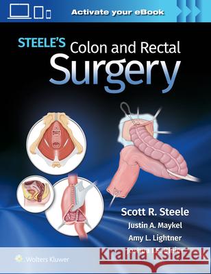 Steele's Colon and Rectal Surgery Scott Steele 9781975152895