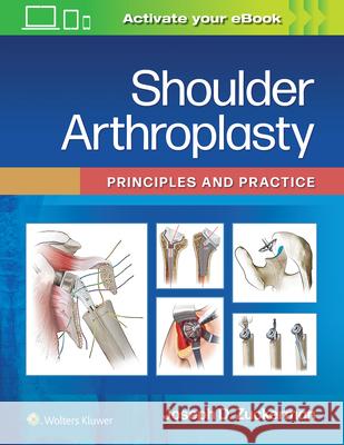 Shoulder Arthroplasty: Principles and Practice Joseph D. Zuckerman 9781975157661 LWW